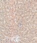 RAB1B Antibody (C-term)